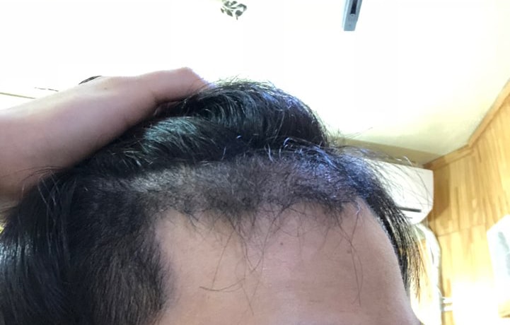 第3个月... 迎来了黑暗期 现在渐渐上来了~