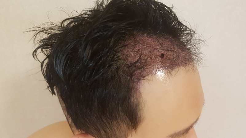 KakaoTalk_20180425_051053079.jpg