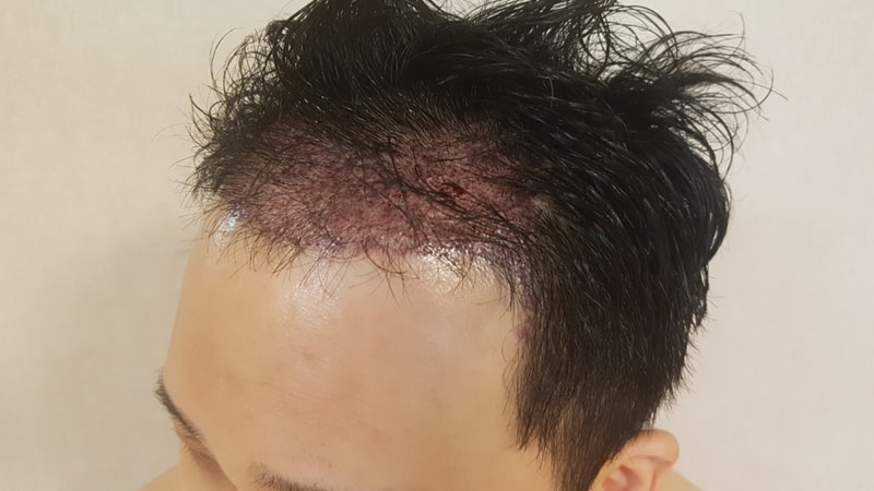 KakaoTalk_20180425_051055306.jpg