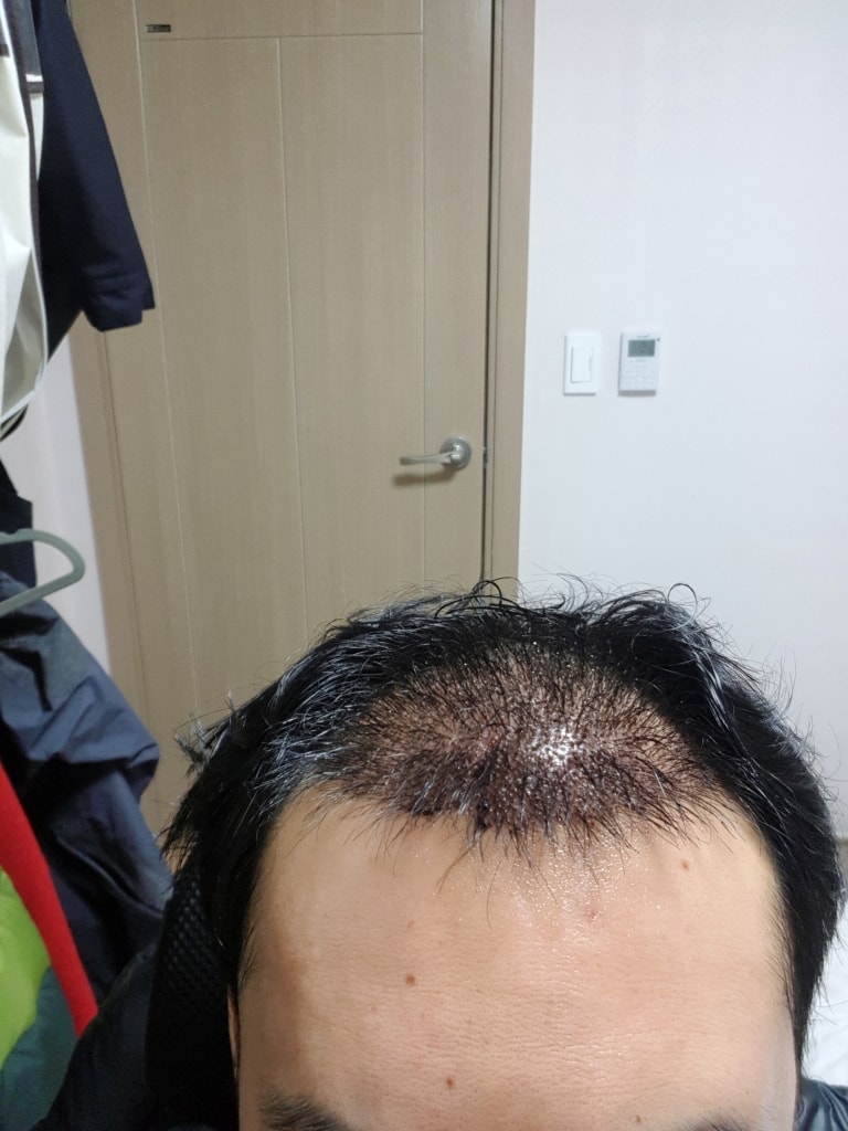 [회전]20190317_5일차.jpg