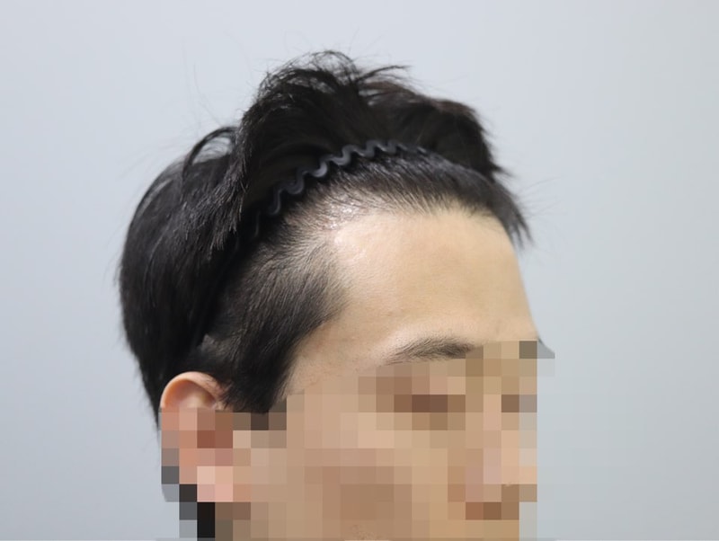 4개월 측면2.jpg