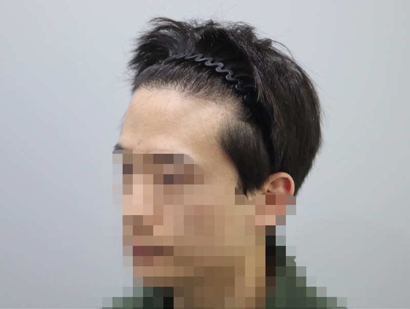 4개월 측면1.jpg