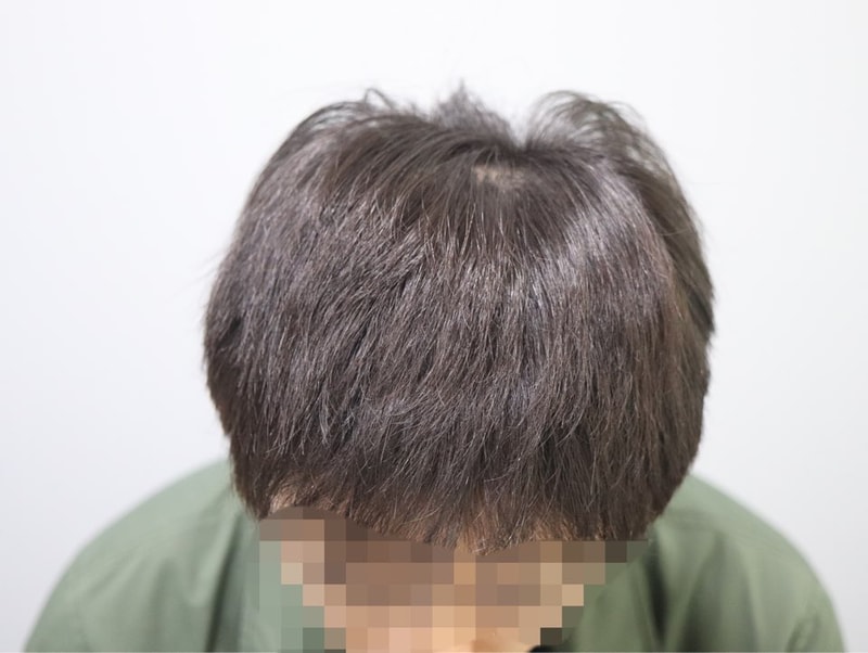 4개월 내린머리.jpg