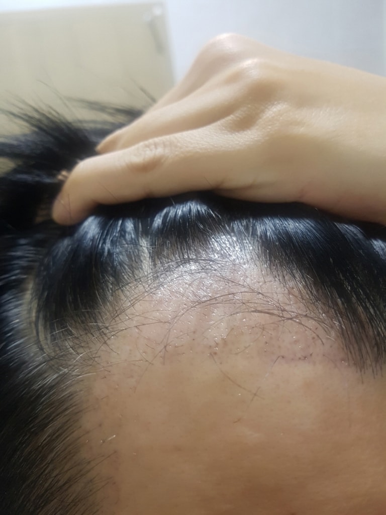 회전_크기변환_20180722_230535.jpg