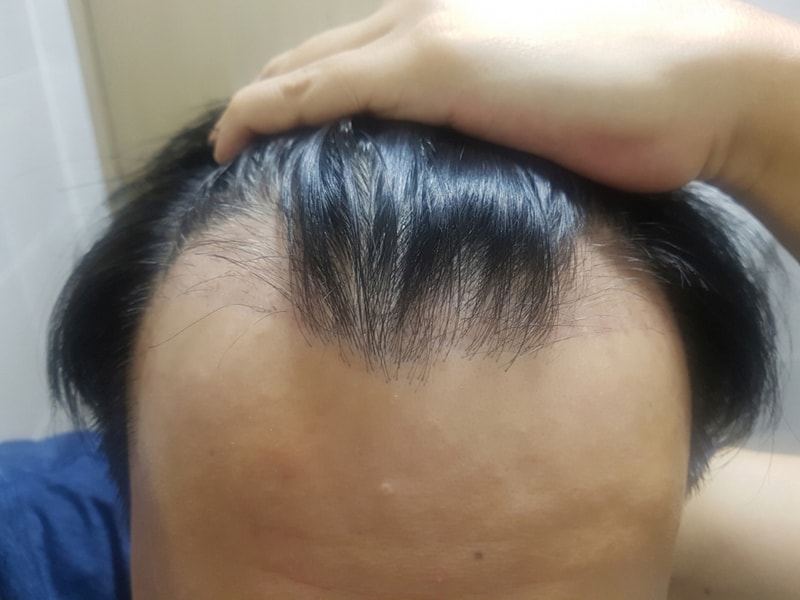 회전_크기변환_20180722_230604.jpg