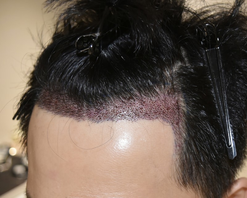 수술1일차2.jpg