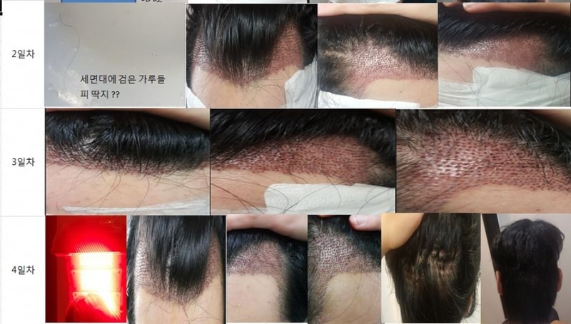 캡처123123213.JPG
