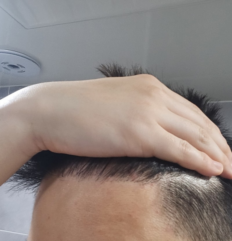 (New Hair Seoul Branch) This is the first year review of the non-cut 3000 Mo.