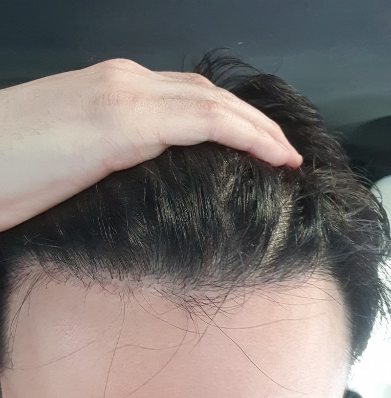 3차 수술 후 오랜만에 접속했네요