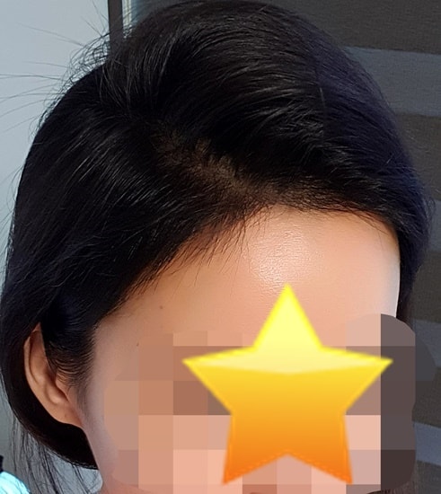 수술후2 2.jpg