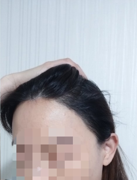 7个月后期