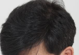 수술후3.JPG
