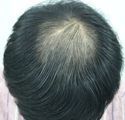 수술전2.JPG
