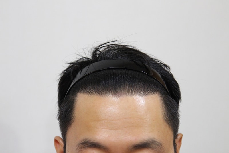 후1.JPG