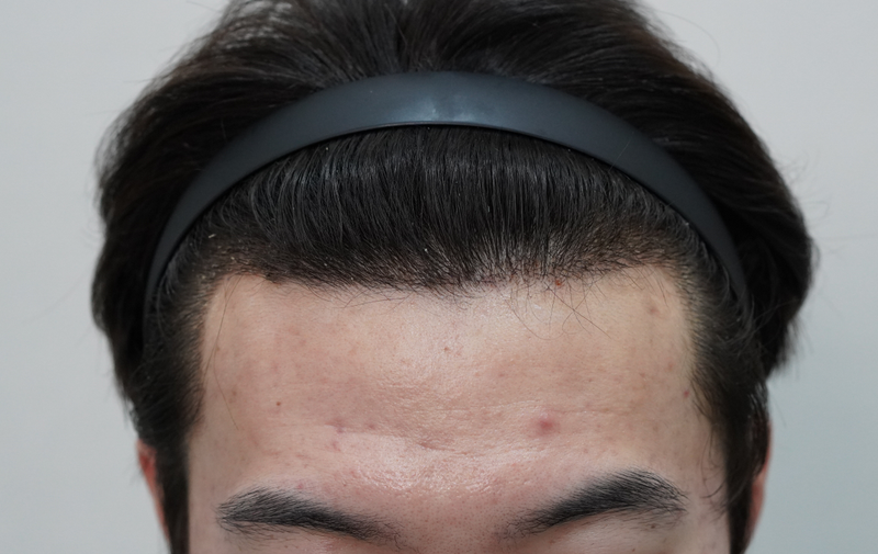 4.png