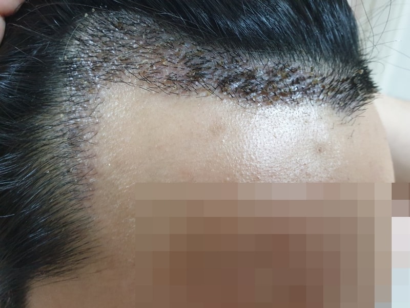 모자이크_왼.jpg