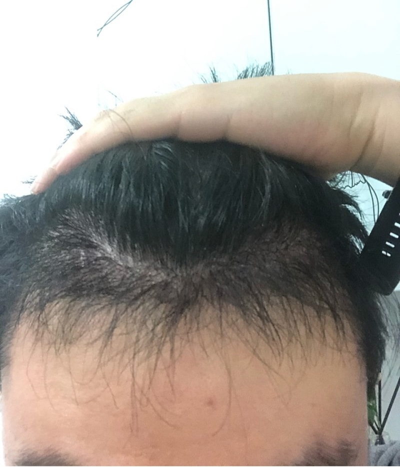 6개월-.jpg