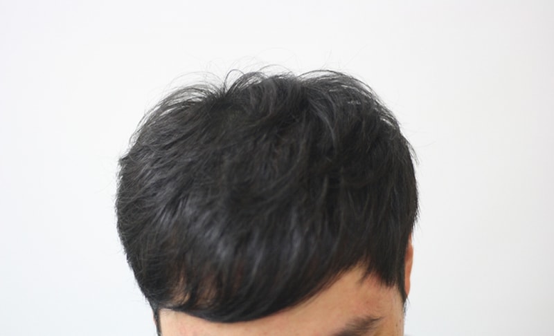 수술후.jpg