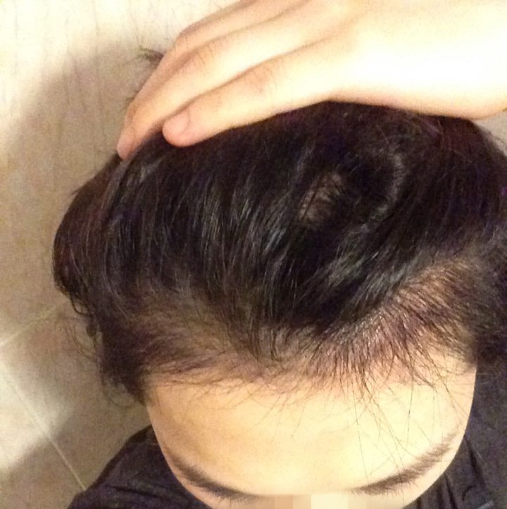 06.노민준 5달.jpeg