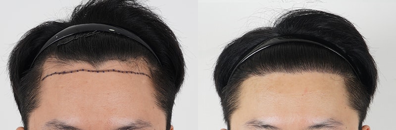 포토후기 이미지