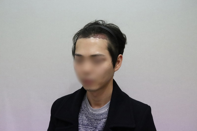 11.노민준_수술다음날3.JPG