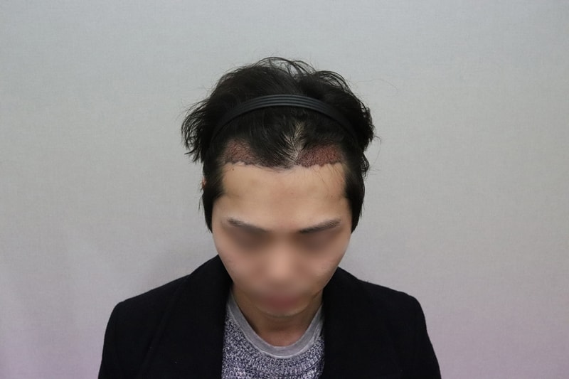 10.노민준_수술다음날2.JPG
