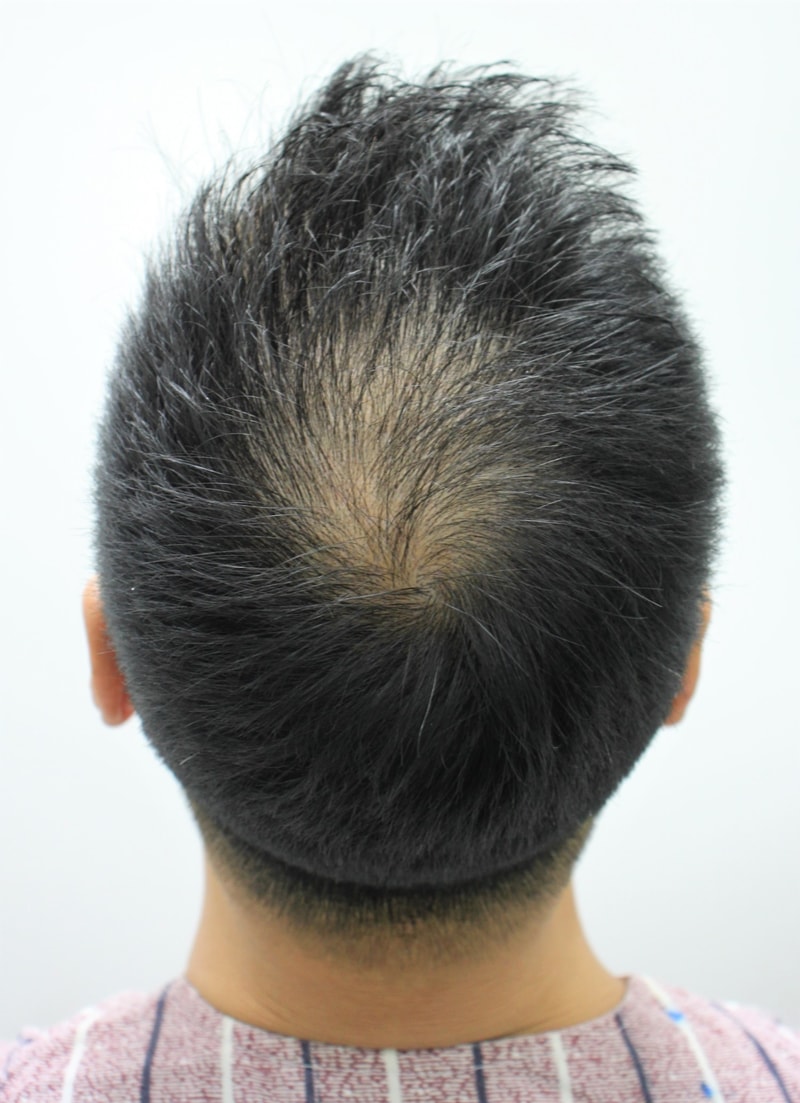 3.수술전.JPG