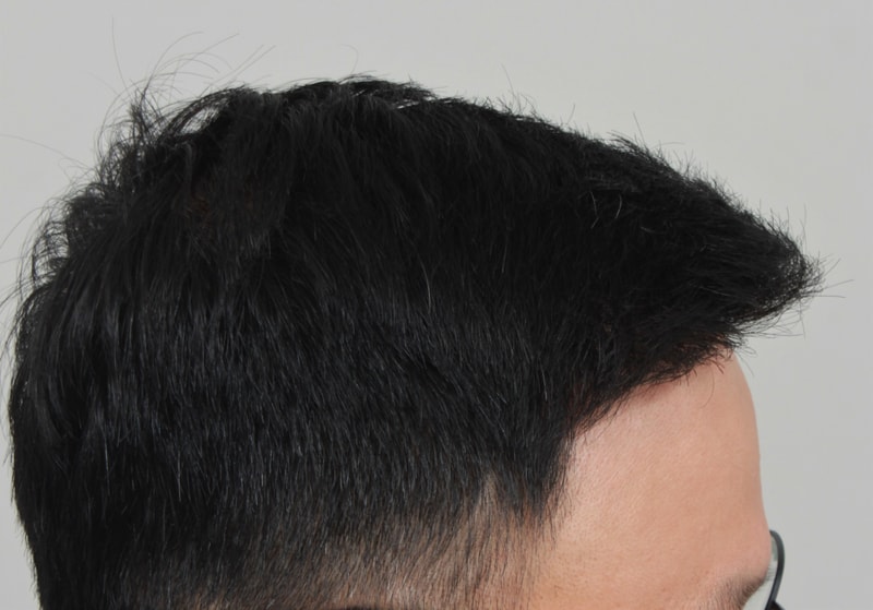 10.수술후.JPG