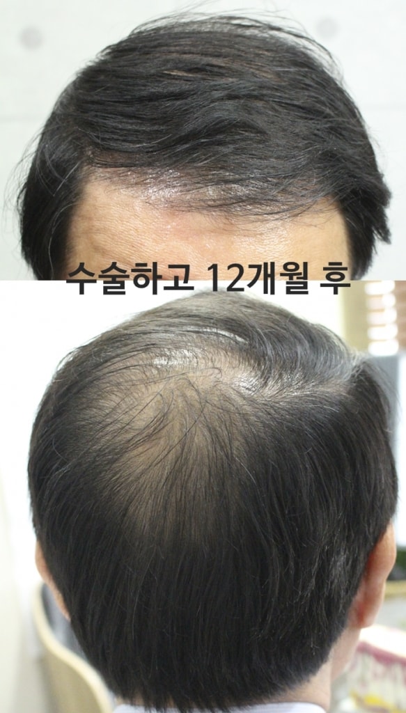 12개월.jpg