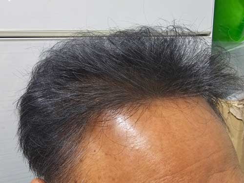 나의이마 4.jpg