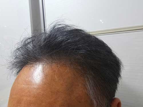 나의이마.jpg