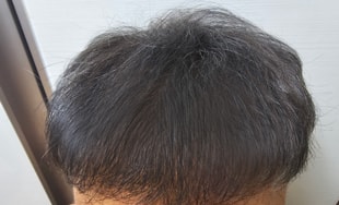 23개월째정면보기.jpg