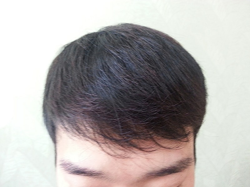 후.jpg