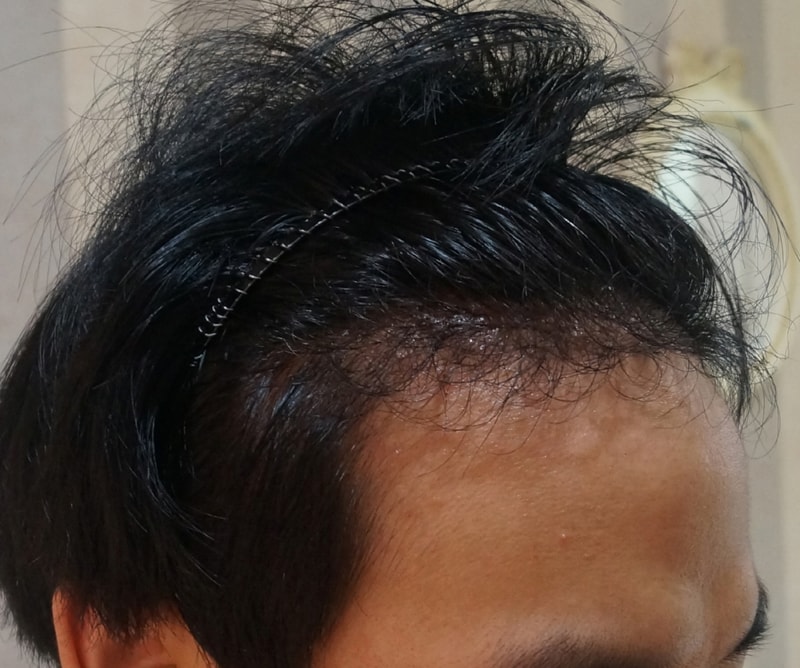 수술후1.jpg