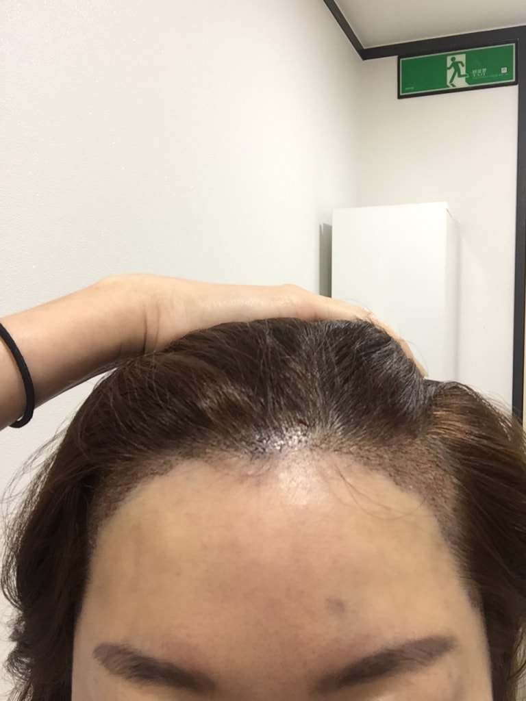 KakaoTalk_20170913_172845908.jpg