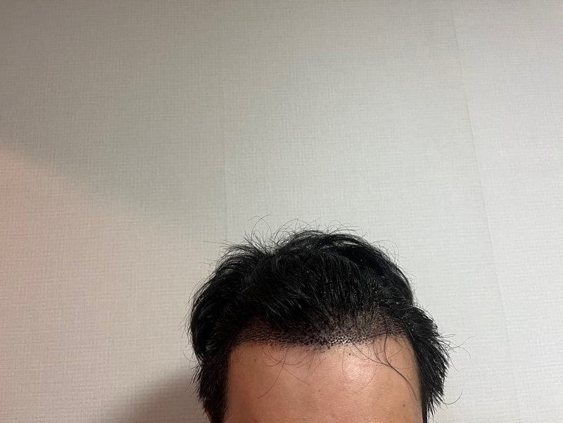 수술 6일 차1.jpg