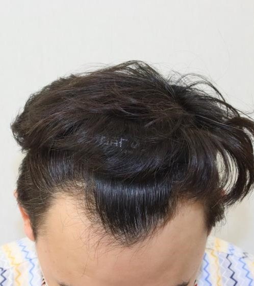 전 3.JPG