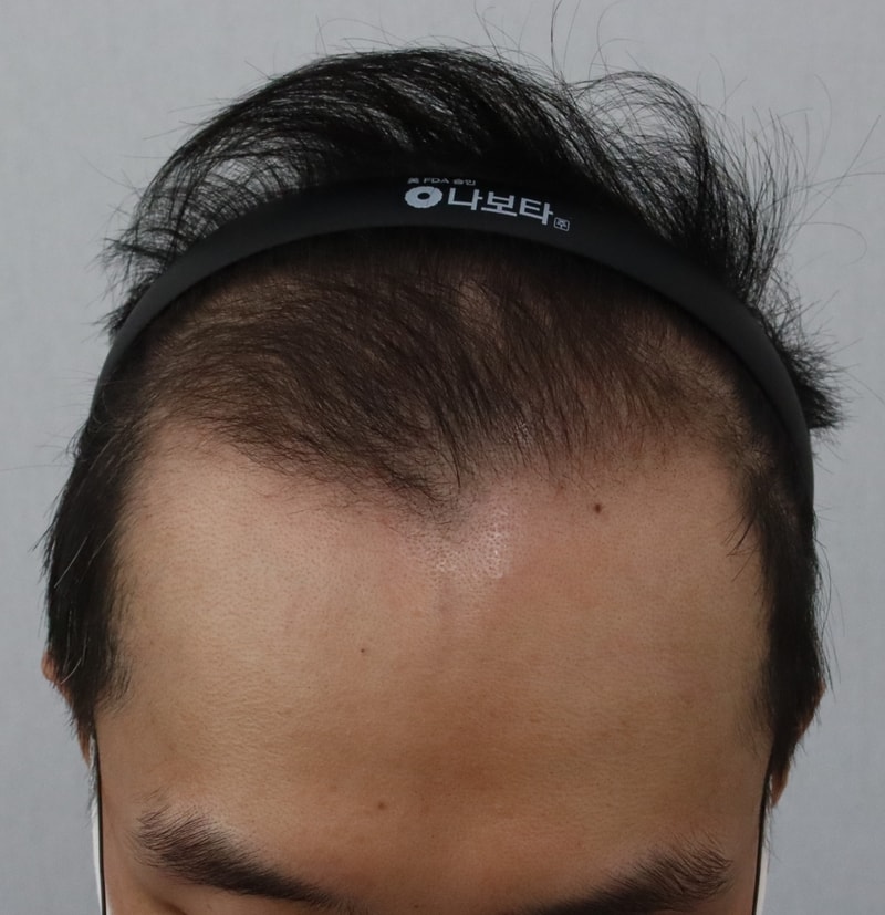 전 2fjxhgj.JPG