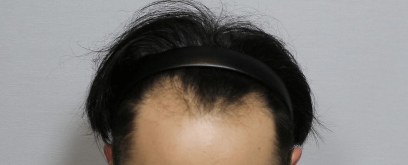 KakaoTalk_20210209_143734516.png
