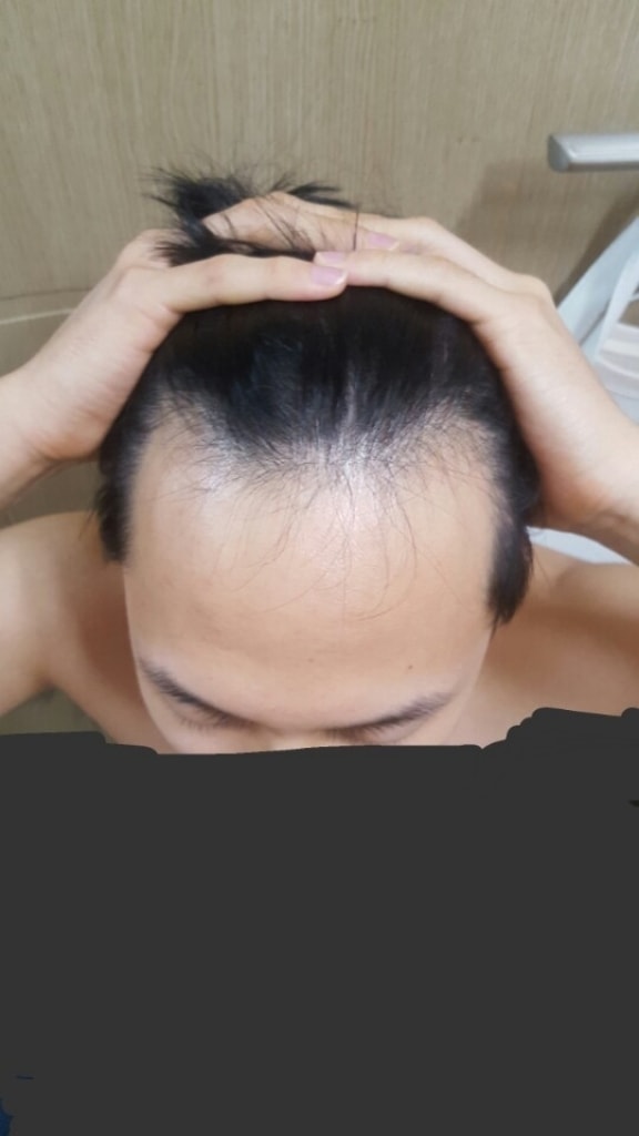수술전날.jpg