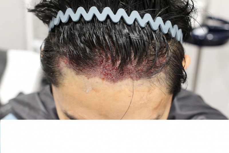 수술당일 위에서본것.jpg