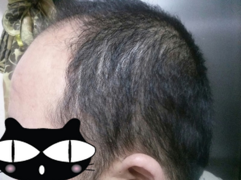 옆.jpg