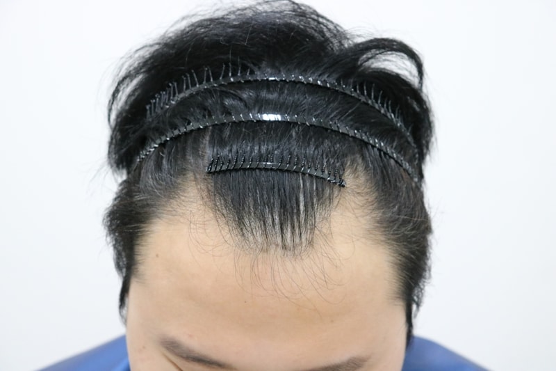 1535439984106.jpg