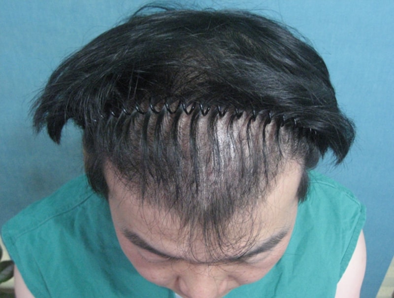 수술전-이광교.jpg