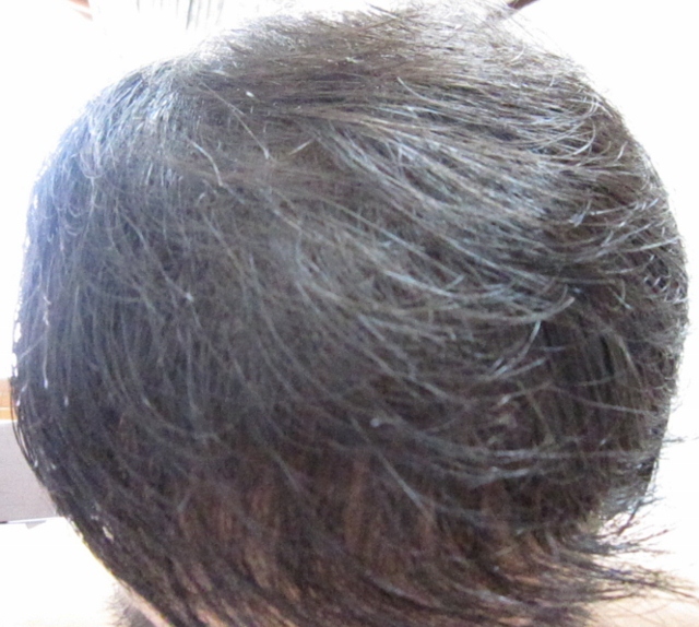 직사광선2(640x574).jpg