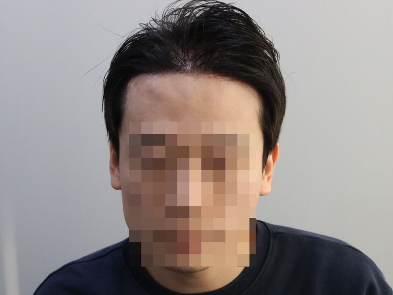 수술 다음날.JPG