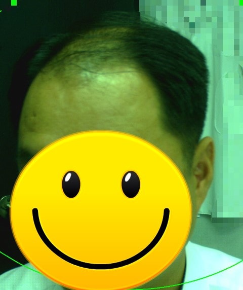 %B8%F0%B9%DF%C0%CC%BD%C4%C0%FC_%281%29.jpg
