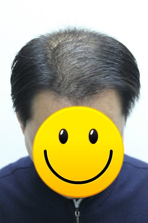 %C3%D6%BF%EC%C3%B64%B4%DE_%283%29.jpg