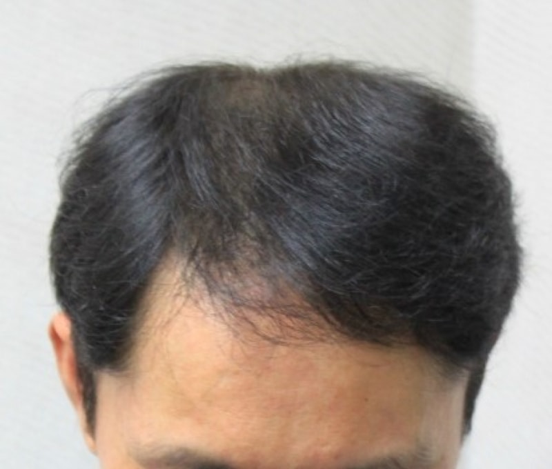수술전3.jpg