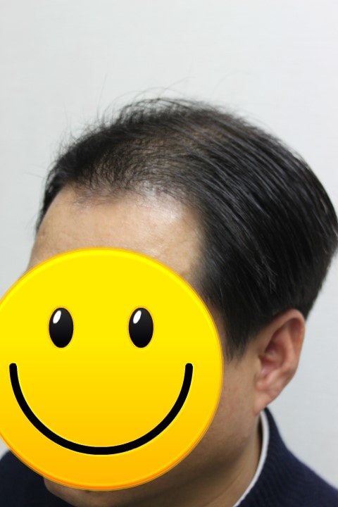 %C3%D6%BF%EC%C3%B64%B4%DE_%285%29.jpg
